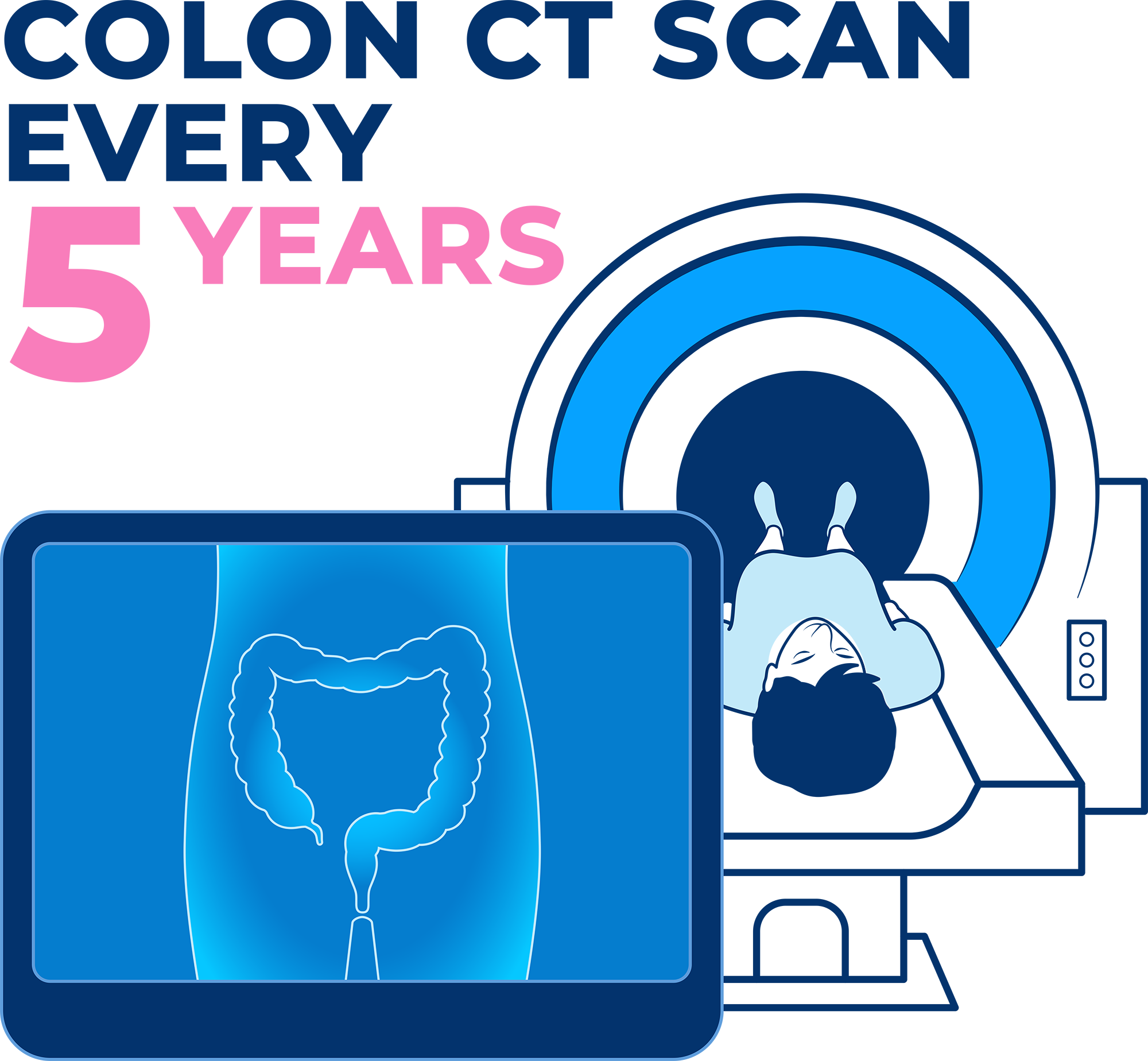 Colon CT scan